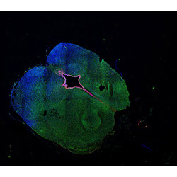 11PCW human midbrain
